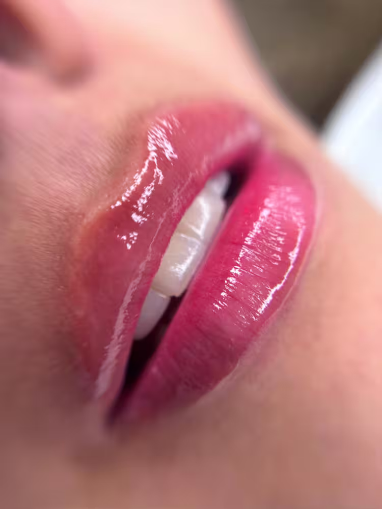 Hidratación Profunda